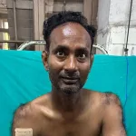 অলৌকিকভাবে প্রাণে বাঁচলেন খোকন! ফুসফুস ফুঁড়ে বেরিয়ে গিয়েছিল গাছের ডাল