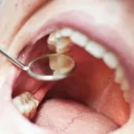 🦷 গরমে দাঁতের যত্নে গাফিলতি নয়! এই ৭টি অভ্যাসই হতে পারে আপনার হাসির সুরক্ষা-চাবি